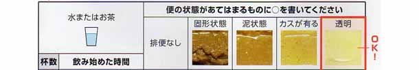 内視鏡検査・ポリープ切除手術
